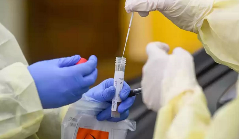 काठमाडौँको बूढानीलकण्ठ नगरपलिकामा २१ जनामा आरडिटी पोजेटिभ