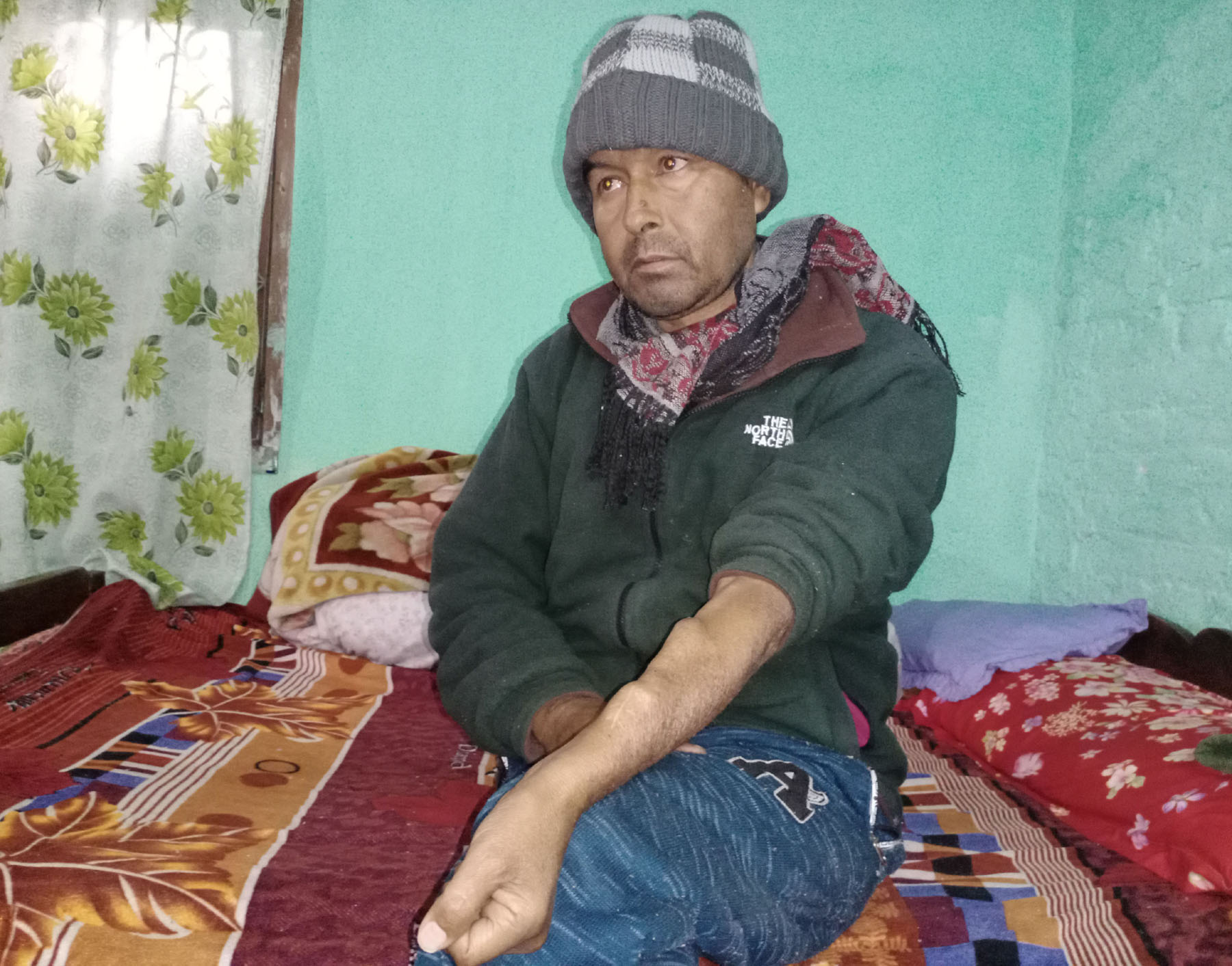 दुवै मिर्गौलापीडित खत्रीको उपचारमा समस्या