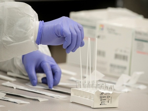 Brazil reports 164 more deaths, 4,164 new cases of COVID-19