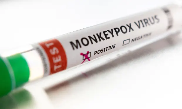 U.S. reports over 3,500 monkeypox cases
