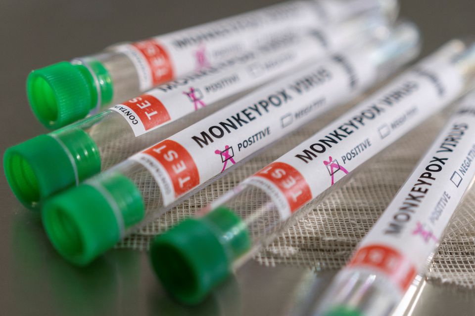 Peru faces “community transmission” of monkeypox: top health official