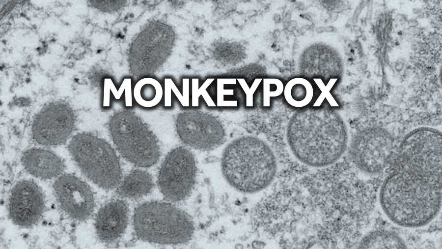 Canada confirms 890 monkeypox cases